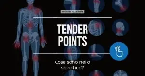 tender points