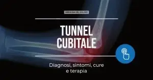 sindrome del tunnel cubitale