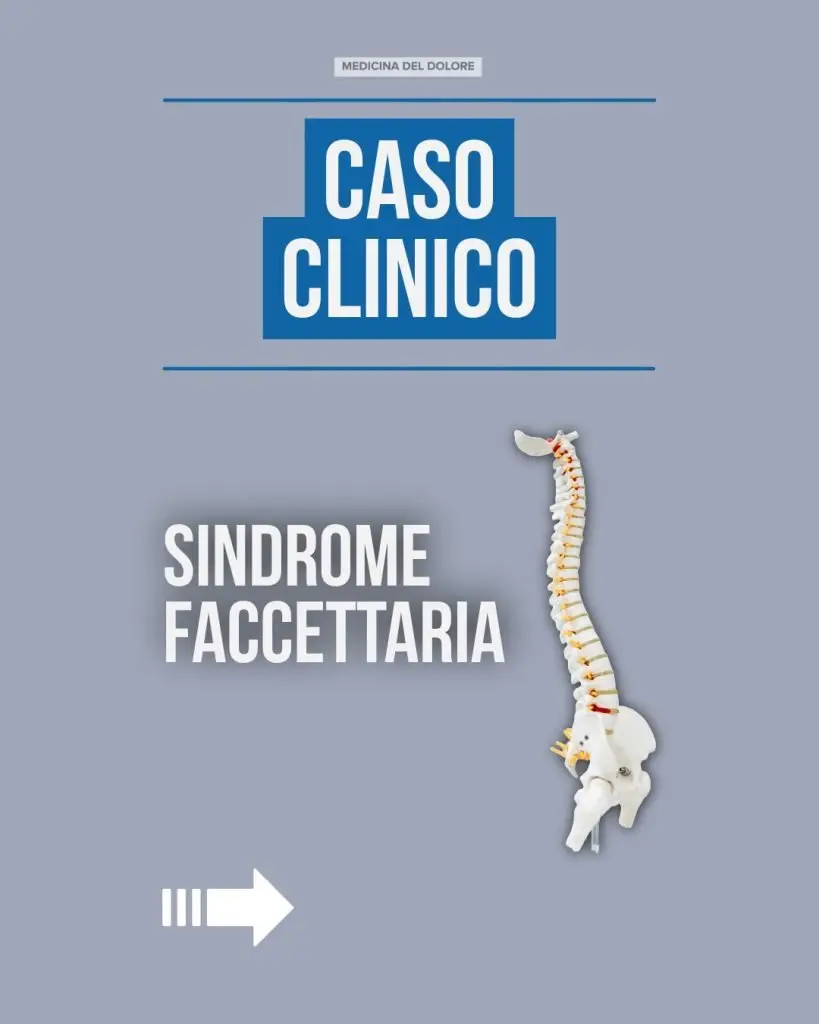 Caso clinico: Sindrome delle faccette articolari 2 Caso clinico: Sindrome delle faccette articolari Medicina del Dolore