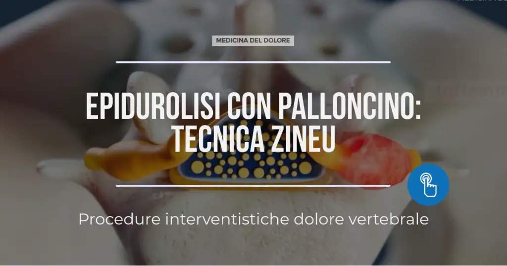 tecnica zineu
